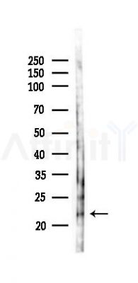 BRP44 Antibody - Western blot analysis of lysates from K562 cells(UV 30min treatment), using BRP44 Antibody at 1/1000 dilution.