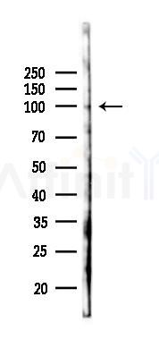 APC2 Antibody - Western blot analysis of lysates from K562 cells(UV 30min treatment), using APC2 Antibody at 1/1000 dilution.