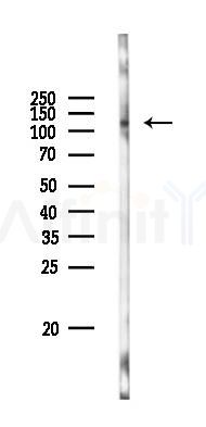 srGAP2 Antibody - Western blot analysis of lysates from PC12 cells(LPS 4h treatment), using srGAP2 Antibody at 1/1000 dilution.