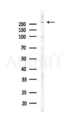DNAH7 Antibody - Western blot analysis of lysates from COLO205 cells(UV 30min treatment), using DNAH7 Antibody at 1/1000 dilution.