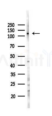 SH3PXD2B Antibody - Western blot analysis of lysates from K562 cells(UV 30min treatment), using SH3PXD2B Antibody at 1/1000 dilution.