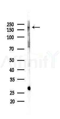 NRAP Antibody - Western blot analysis of lysates from Mouse lung, using NRAP Antibody at 1/1000 dilution.