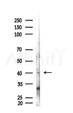 CCN3 Antibody - Western blot analysis of lysates from Hela cells(starvation 24h treatment), using CCN3 Antibody at 1/1000 dilution.