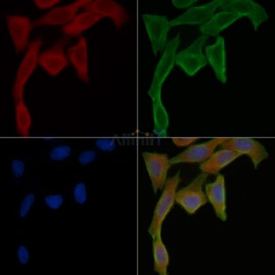 AMPS Antibody - DF13918 staining Hela cells(45min of heat-shock treatment) by IF/ICC.