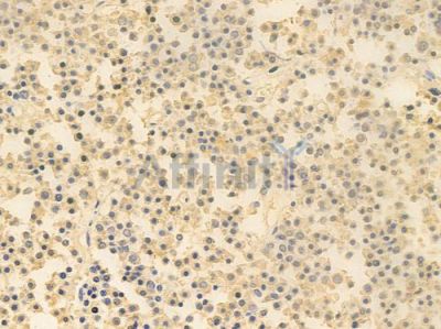 ABLIM3 Antibody - DF13920 at 1/100 staining human pituitary adenoma by IHC-P.