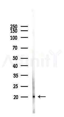 RBP1 Antibody - Western blot analysis of lysates from 293 cells(UV 30min treatment), using RBP1 Antibody at 1/1000 dilution.