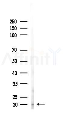 RBP1 Antibody - Western blot analysis of lysates from Hela cells(starvation 24h treatment), using RBP1 Antibody at 1/1000 dilution.