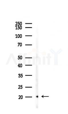 RBP1 Antibody - Western blot analysis of lysates from Mouse lung, using RBP1 Antibody at 1/1000 dilution.