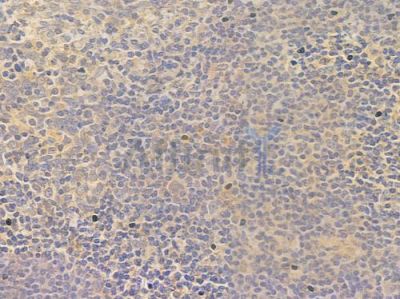 CIAPIN1 Antibody - DF13926 at 1/100 staining human normal tonsil tissue by IHC-P.