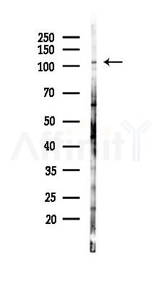 ERAP2 Antibody - Western blot analysis of lysates from Hela cells(starvation 24h treatment), using ERAP2 Antibody at 1/1000 dilution.