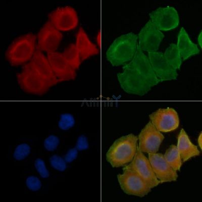 IMPA1 Antibody - DF13947 staining Hela cells(45min of heat-shock treatment) by IF/ICC.