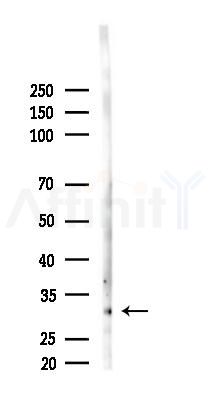 STOM Antibody - Western blot analysis of lysates from Hela cells(starvation 24h treatment), using STOM Antibody at 1/1000 dilution.