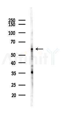 HGFA Inhibitor 1 Antibody - Western blot analysis of lysates from Mouse lung, using HGFA Inhibitor 1 Antibody at 1/1000 dilution.