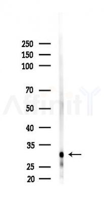 calcyphosine Antibody - Western blot analysis of lysates from Hela cells(starvation 24h treatment), using calcyphosine Antibody at 1/1000 dilution.