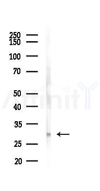 calcyphosine Antibody - Western blot analysis of lysates from Mouse lung, using calcyphosine Antibody at 1/1000 dilution.