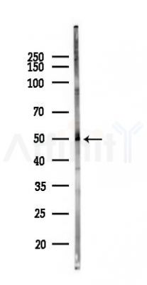 TRIM17 Antibody - Western blot analysis of lysates from Mouse lung, using TRIM17 Antibody at 1/1000 dilution.