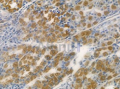 PDE6 delta Antibody - DF13962 at 1/100 staining human normal gastric tissue by IHC-P.