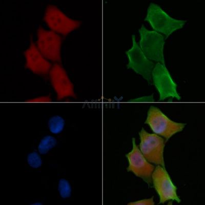 CSN1 Antibody - DF13965 staining Hela cells(45min of heat-shock treatment) by IF/ICC.