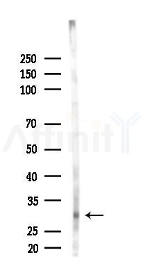 LIME Antibody - Western blot analysis of lysates from Hela cells(starvation 24h treatment), using LIME Antibody at 1/1000 dilution.