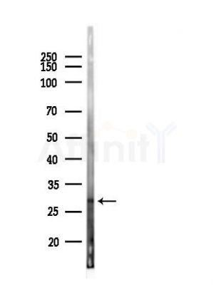 TICAM2 Antibody - Western blot analysis of lysates from Mouse lung, using TICAM2 Antibody at 1/1000 dilution.
