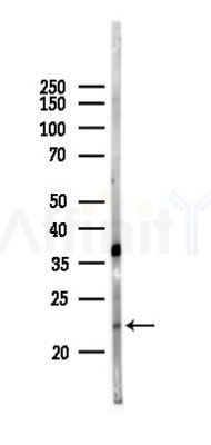 NNT1 Antibody - Western blot analysis of lysates from Rat liver, using NNT1 Antibody at 1/1000 dilution.