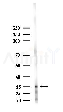 Mucolipin 1 Antibody - Western blot analysis of lysates from Hela cells(starvation 24h treatment), using Mucolipin 1 Antibody at 1/1000 dilution.