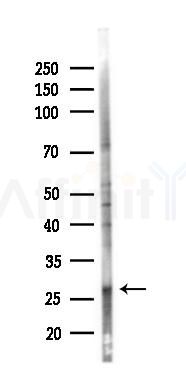 CLIC1 Antibody - Western blot analysis of lysates from PC12 cells(LPS 4h treatment), using CLIC1 Antibody at 1/1000 dilution.