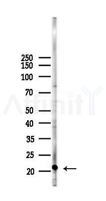 CLIC1 Antibody - Western blot analysis of lysates from K562 cells(heat-shock 45min treatment), using CLIC1 Antibody at 1/1000 dilution.