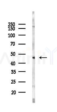 Tbx6 Antibody - Western blot analysis of lysates from COLO205 cells(starvation 24h treatment), using Tbx6 Antibody at 1/1000 dilution.