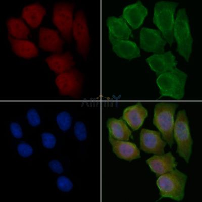 U1A Antibody - DF13997 staining Hela cells(45min of heat-shock treatment) by IF/ICC.