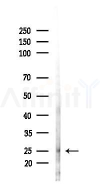 COQ10B Antibody - Western blot analysis of lysates from Hela cells(starvation 24h treatment), using COQ10B Antibody at 1/1000 dilution.