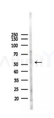 FbxL7 Antibody - Western blot analysis of lysates from K562 cells(heat-shock 45min treatment), using FbxL7 Antibody at 1/1000 dilution.