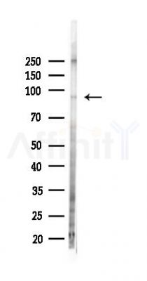 Neurotrypsin  Antibody - Western blot analysis of lysates from PC12 cells(LPS 4h treatment), using Neurotrypsin  Antibody at 1/1000 dilution.