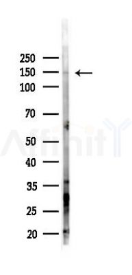 FNIP1 Antibody - Western blot analysis of lysates from PC12 cells(LPS 4h treatment), using FNIP1 Antibody at 1/1000 dilution.