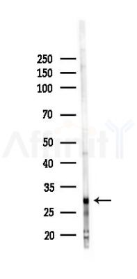 SLC25A38 Antibody - Western blot analysis of lysates from PC12 cells(LPS 4h treatment), using SLC25A38 Antibody at 1/1000 dilution.