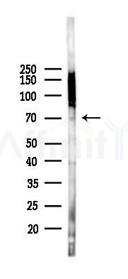SLC20A2 Antibody - Western blot analysis of lysates from K562 cells(heat-shock 45min treatment), using SLC20A2 Antibody at 1/1000 dilution.