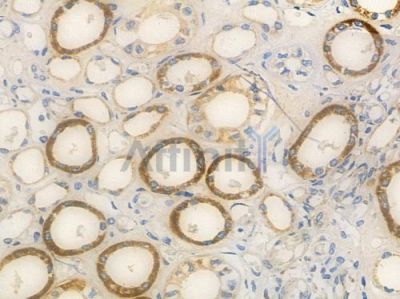 DCYTB Antibody - DF14043 at 1/100 staining human normal kidney tissue by IHC-P.