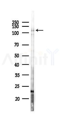 NCAPG2 Antibody - Western blot analysis of lysates from Mouse lung, using NCAPG2 Antibody at 1/1000 dilution.
