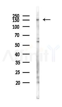 DHX29 Antibody - Western blot analysis of lysates from COLO205 cells(starvation 24h treatment), using DHX29 Antibody at 1/1000 dilution.