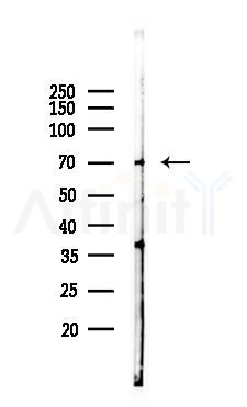 PPM1G Antibody - Western blot analysis of lysates from K562 cells(UV 30min treatment), using PPM1G Antibody at 1/1000 dilution.