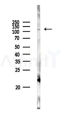 BRD1 Antibody - Western blot analysis of lysates from PC12 cells(LPS 4h treatment), using BRD1 Antibody at 1/1000 dilution.