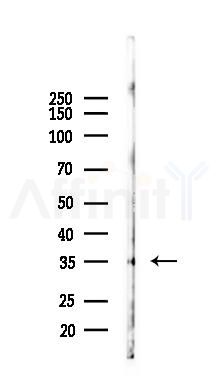 GPCR TGR5 Antibody - Western blot analysis of lysates from Rat liver, using GPCR TGR5 Antibody at 1/1000 dilution.