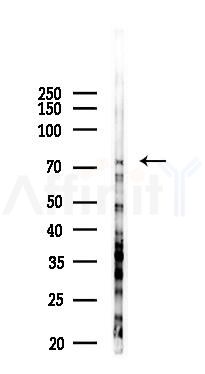C2 Antibody - Western blot analysis of lysates from PC12 cells(LPS 4h treatment), using C2 Antibody at 1/1000 dilution.