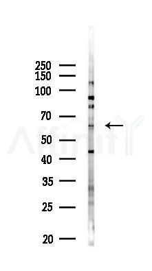 LOXL1 Antibody - Western blot analysis of lysates from PC12 cells(LPS 4h treatment), using LOXL1 Antibody at 1/1000 dilution.