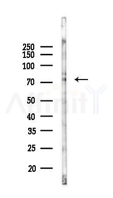 RNF139 Antibody - Western blot analysis of lysates from B16F10-LUC cells(UV 30min treatment), using RNF139 Antibody at 1/1000 dilution.