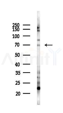 ST6GALNAC1 Antibody - Western blot analysis of lysates from COLO205 cells(starvation 24h treatment), using ST6GALNAC1 Antibody at 1/1000 dilution.