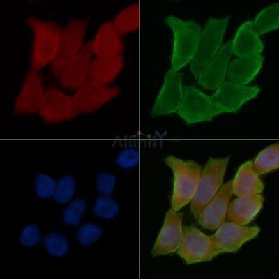 TRIM72 Antibody - DF14098 staining Hela cells(45min of heat-shock treatment) by IF/ICC.