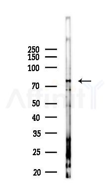 SLC26A3 Antibody - Western blot analysis of lysates from PC12 cells(LPS 4h treatment), using SLC26A3 Antibody at 1/1000 dilution.