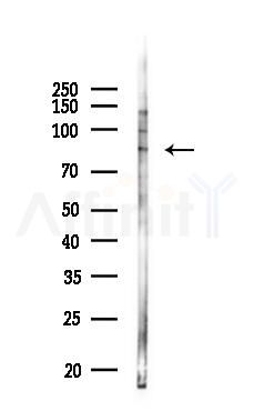 C14orf37 Antibody - Western blot analysis of lysates from PC12 cells(LPS 4h treatment), using C14orf37 Antibody at 1/1000 dilution.