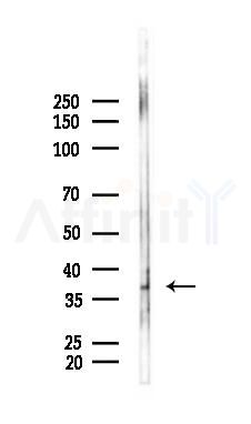 ACOT7 Antibody - Western blot analysis of lysates from Mouse lung, using ACOT7 Antibody at 1/1000 dilution.